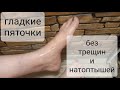 Гладкие пяточки! Без Трещин и Натоптышей! Супер средство для ног!