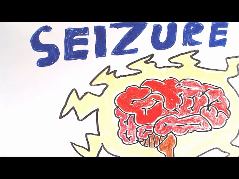 What are seizures?