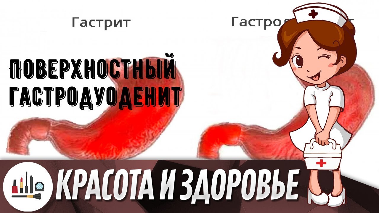 Поверхностный гастродуоденит