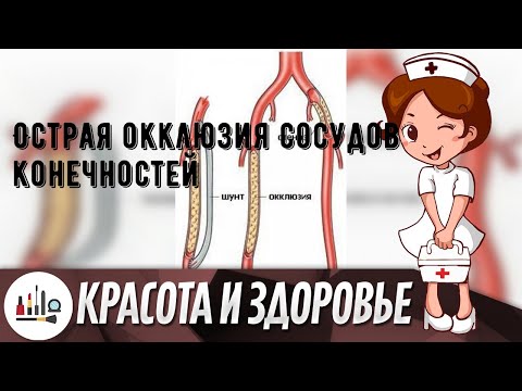 Острая окклюзия сосудов конечностей