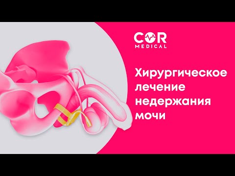 Хирургическое лечение недержания мочи