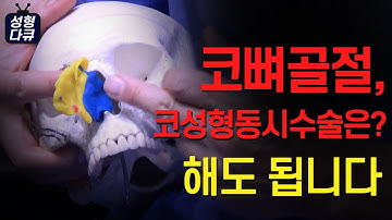 [강남삼성성형외과 코성형편]15편 코뼈골절? 코성형 같이 할수 있을까? 할 수 있습니다