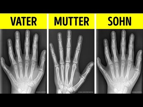 Video: Interessante Fakten über Polydactyl Cats