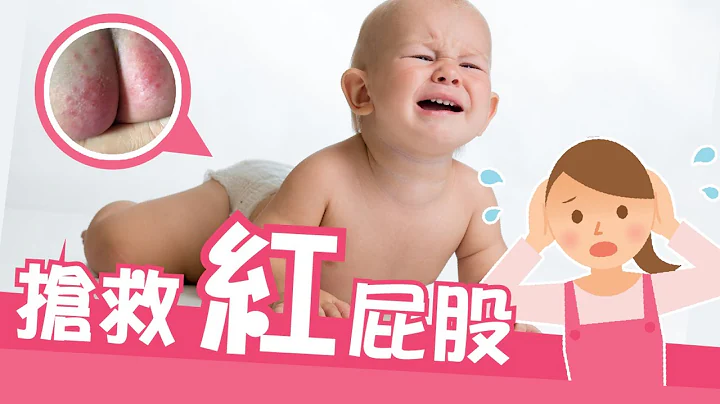 尿布疹又来？！抢救红屁股大作战！ │ 咕咕育婴便利贴 07 │ 贝忘录 - 天天要闻