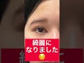 【眉下切開/リフト】一般の方の意見が当てにならない理由 #shorts