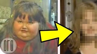 В 7 Лет Она Весила 220 кг...Врачи Были в Ужасе...Посмотрите на Нее Сейчас! В 7 Лет Она Весила 220 кг...Врачи Были в Ужасе...Посмотрите на Нее Сейчас!