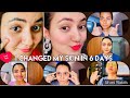 DAY 6 : 1 WEEK SKIN TRANSFORMATION CHALLENGE | Promising 100% Healthy & Glowing Skin in Just 6 Days💕