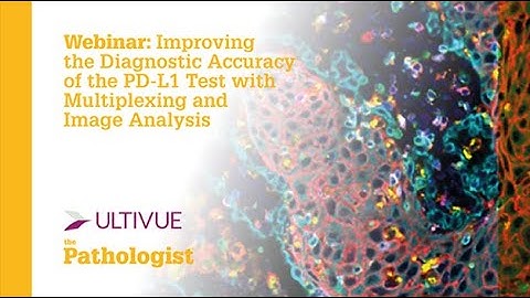 Improving the Diagnostic Accuracy of the PD-L1 test with Multiplexing and Image Analysis