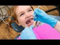 BRAVE DENTiST VISIT!!  Adley has a tooth check up at our clinic and gets her vampire teeth cleaned!