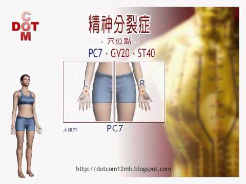 精神分裂症DIY穴位能療法【12MH】