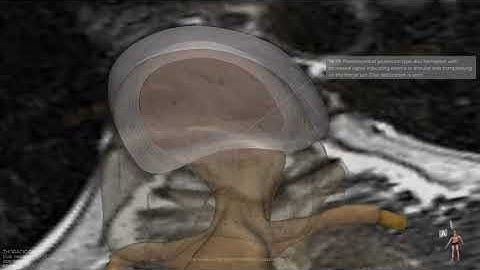 3D Video Rendering of the Thoracic Spine - Quality - Amazing Settlement