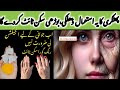 ✅To Get Rid Of Wrinkles With Alum | How To kitchen Clean &amp; Organized | Kitchen Hacks &amp; Tips