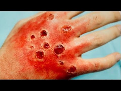 CORONAVIRUS: 9 CHOSES QUE VOUS IGNOREZ CORONAVIRUS: 9 CHOSES QUE VOUS IGNOREZ