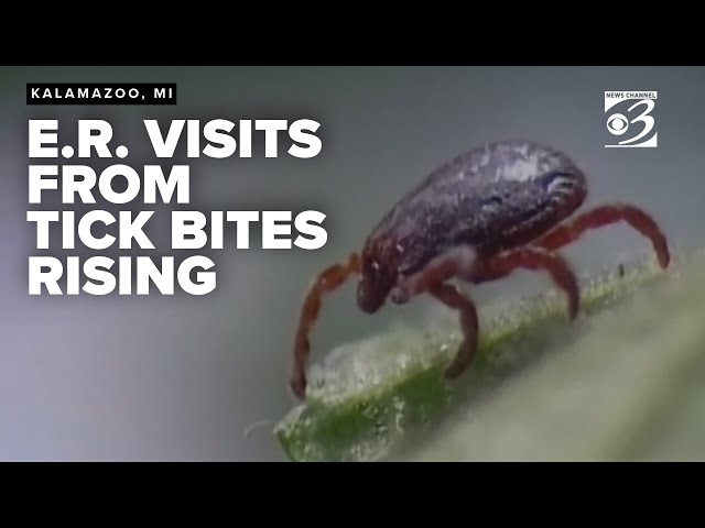 Tick bite emergency visits in 2025 rise sharply in Midwest, data