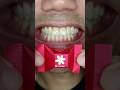 Gracias Chocolate Ritter SPORT Cubes Thank You #Doctor Tristan Peh #ASMR #shorts