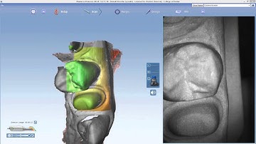 E4D video 2 Scan the preparation Scanner care removed