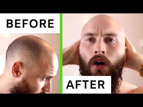 HARRY'S RAZOR - BALDING HEAD SHAVE REVIEW