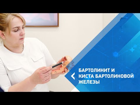 Европейский стандарт лечения бартолиновой железы