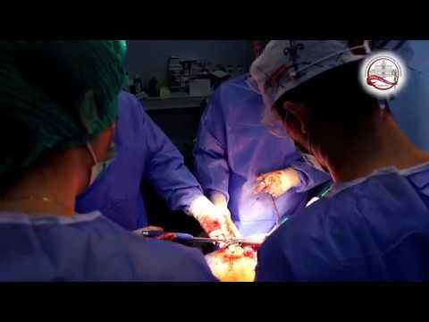 Video: Dislocarea Articulației șoldului