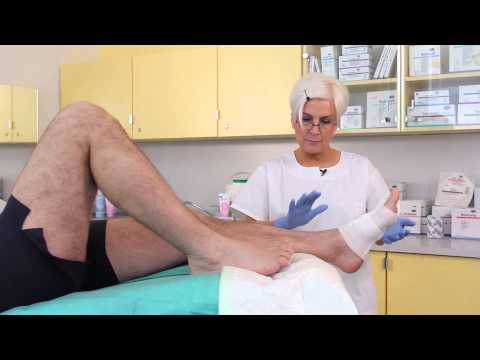 Video: Modré Nehty Na Nohou: Příčiny, Ošetření A Kdy Navštívit Lékaře