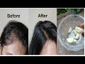 Grandma's SECRET Recipe for Hair growth in 30 days Garlic & Coconut hair oil treatment