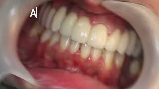 We Make Smiles, We Make Self Confidence - Nordent Dental Center