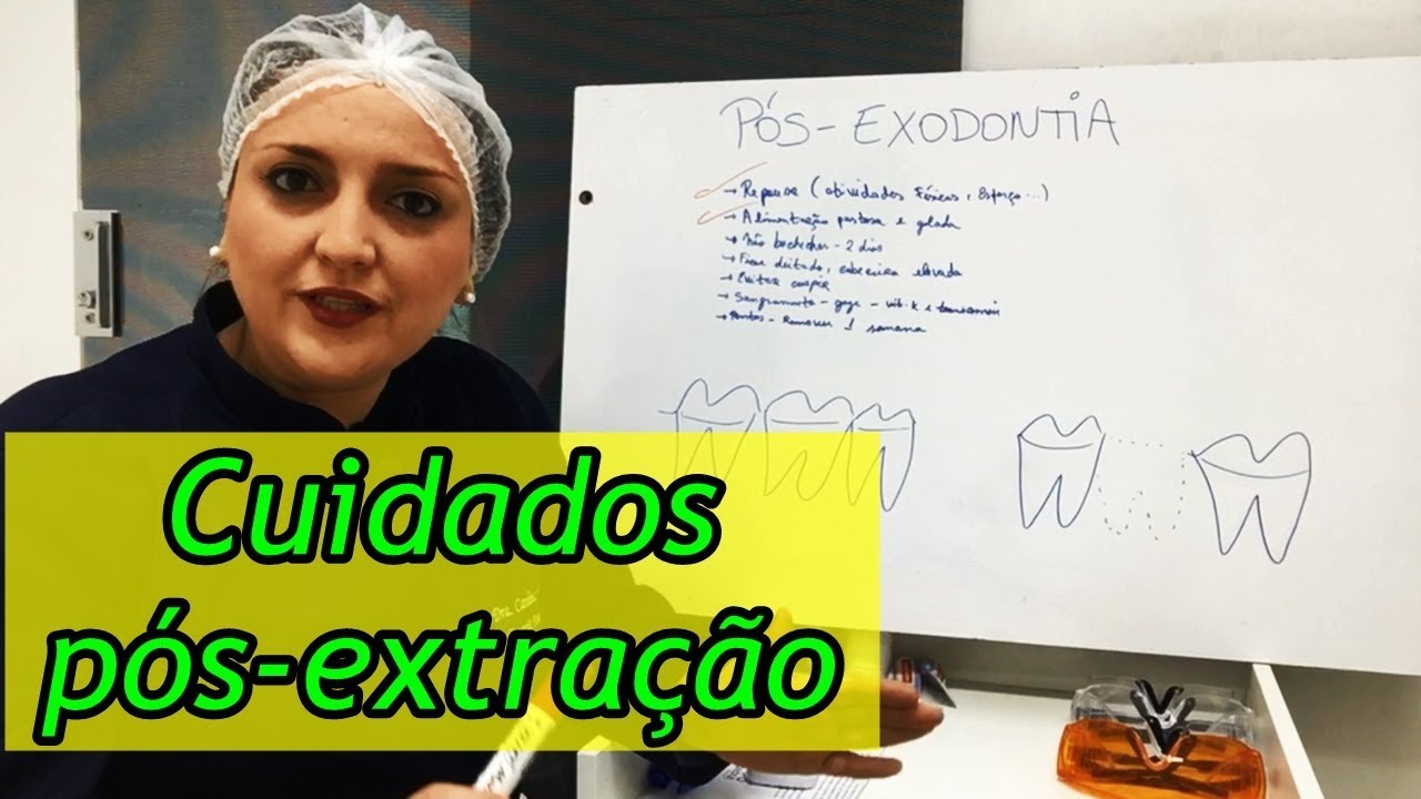 Quais os Cuidados você deve ter após a extração de dente?
