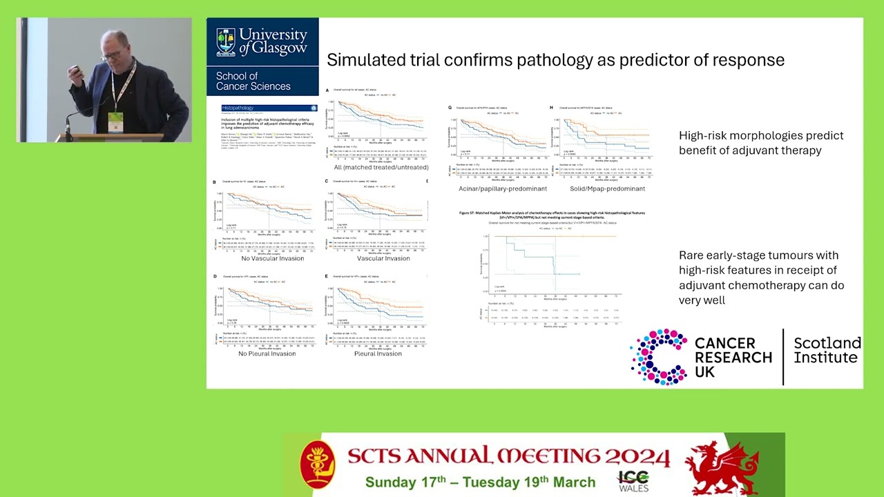 John Le Quesne - Predicting recurrence of pulmonary adenocarcinoma and the value of adjuvant