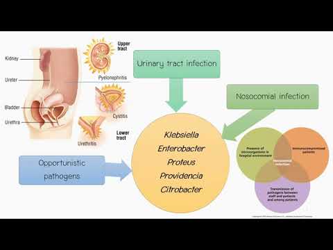 โรคติดเชื้อที่ระบบทางเดินอาหาร (Escherichia coli)