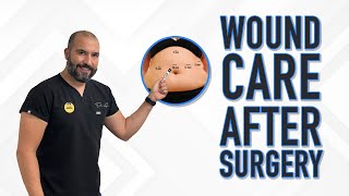 Wound Care After Surgery 🤕🩹 | Gastric Sleeve Surgery | Questions & Answers screenshot 3