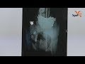 امرأة في المثنى تبتلع كيلو غرام من المسامير الحديدية المربد امرأة في المثنى تبتلع كيلو غرام من المسامير الحديدية المربد