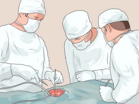 Vídeo: ¿Cuándo Es La Cirugía Una Opción Para La Enfermedad De Crohn? Línea De Salud