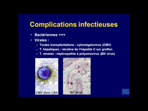 Vidéo: L'effet Thérapeutique De La Transplantation De Cellules Souches Mésenchymateuses Dans L'encéphalomyélite Auto-immune Expérimentale Est Médié Par Des Mécanismes Périphériq