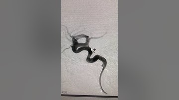 Stent assisted coiling of wide neck cerebral aneurysm