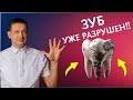 Не Игнорируйте Эти 5 ПРИЗНАКОВ - Стоматолог Раскрывает Правду