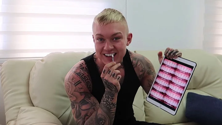 Matthew Downing : Veneers Turkey Review (2019) #VE...