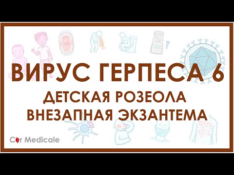 Детская розеола или внезапная экзантема - герпес 6 типа -  причины, клинические проявления и др.