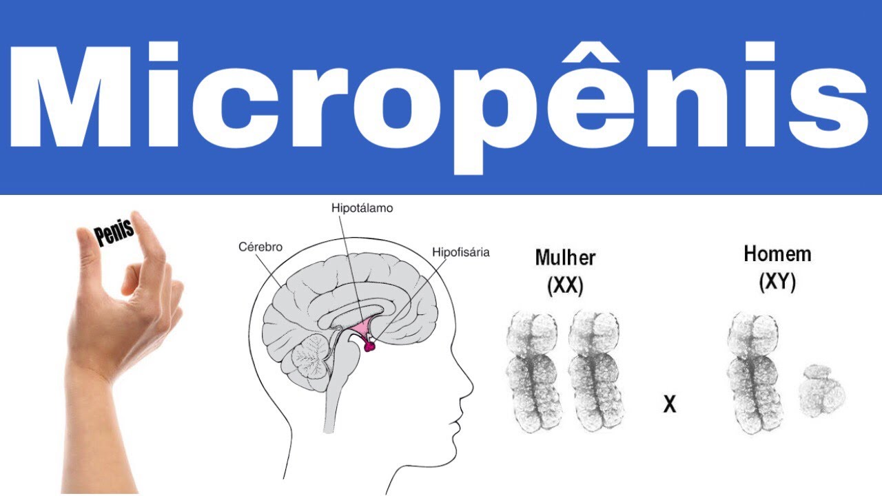 Micropênis YouTube Micropênis YouTube