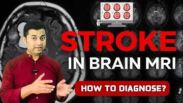 Decoding MRI Sequences: How to Identify Stroke in Brain Imaging Like a Pro