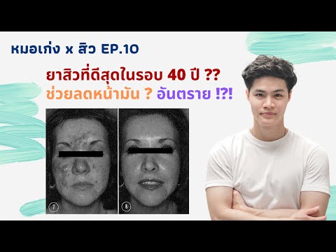 วีดีโอ: วิธีป้องกันผมร่วงขณะใช้ Accutane: 10 ขั้นตอน