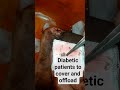 Diabetic foot wound patients to be cover the wounds properly and off loading is the key to healing