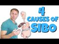 4ish Common Causes Of SIBO Small Intestinal Bacterial Overgrowth 4ish Common Causes Of SIBO Small Intestinal Bacterial Overgrowth