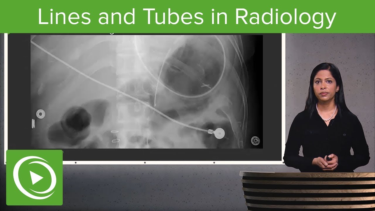 ⁣Lines and Tubes in Radiology – Radiology | Lecturio