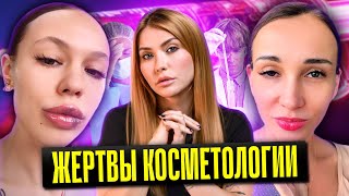 Жертвы Косметологии I Инстасамка Филлер I Анфиса Чехова Ботокс