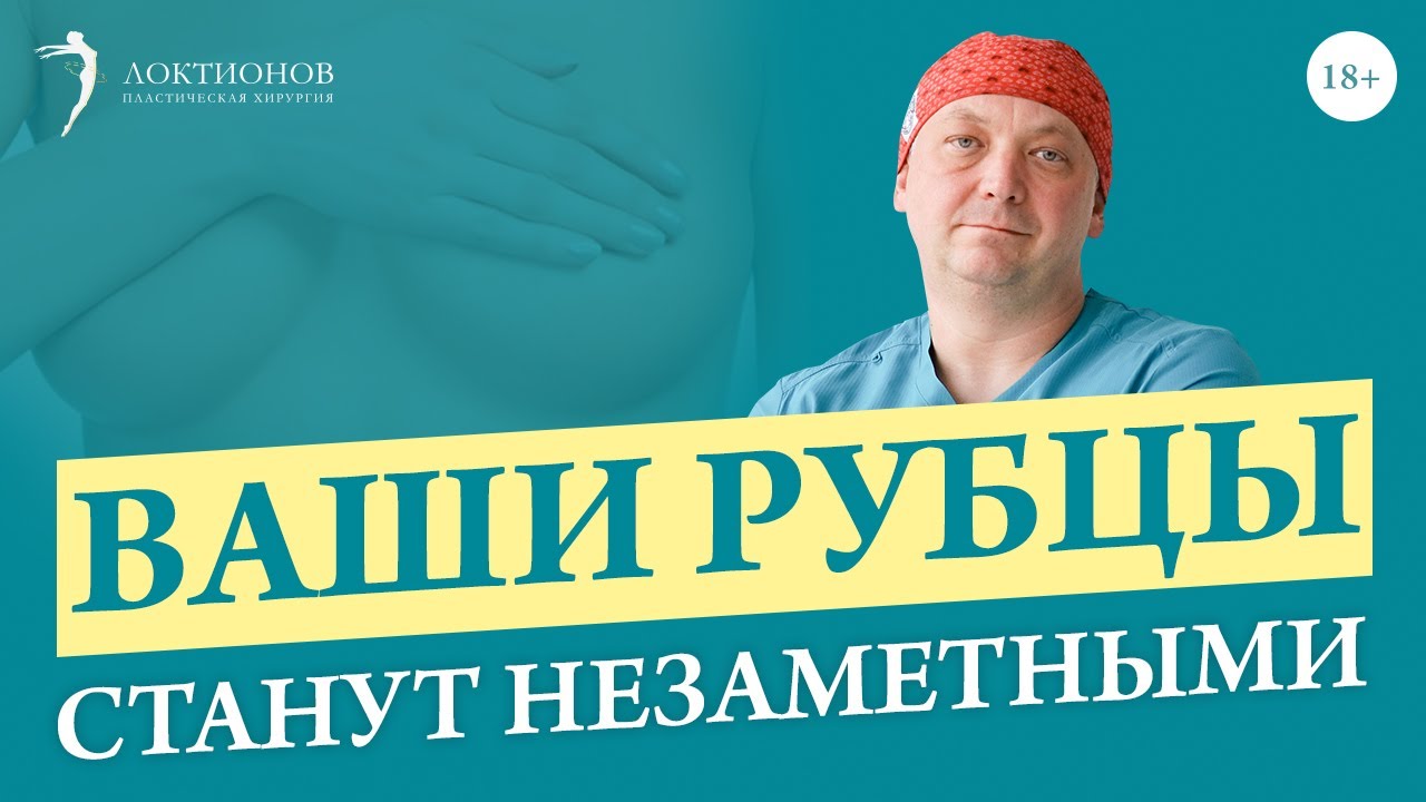 Как убрать шрамы после увеличения и подтяжки груди? Как убрать рубцы после маммопластики? / 18+