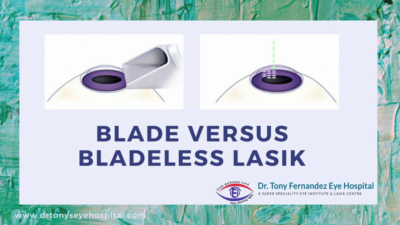 Blade versus Bladeless LASIK YouTube