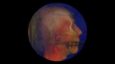 AtomicusChart®: Volume Rendering Customizations