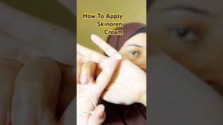 How To Apply Skinoren Cream #azelaicacid #melasma #pigmentation #skincare #shorts #viral #trending