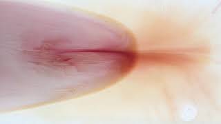 Blood Works 3 - Thinner