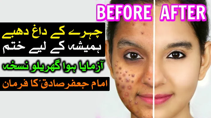 Chehra Noorani Face se Daag Hatane ka Tarika Hazrat Imam Jafar Sadiq as Ka Farman Beautiful Mehrban